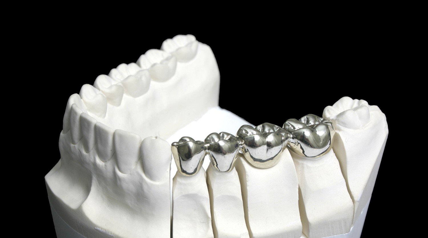 Dental Metal Refiners and Recovery